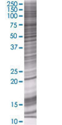 COPS8 transfected lysate.