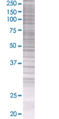 SGOL1 transfected lysate.