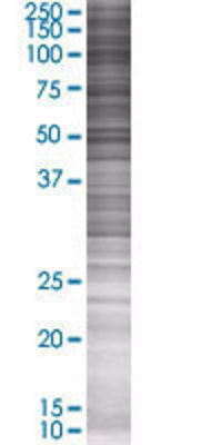 DSC2 transfected lysate.