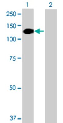 Lane 1: DSC2 transfected lysate (93.28 KDa) Lane 2: Non-transfected lysate.