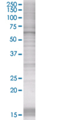 EPHX2 transfected lysate.