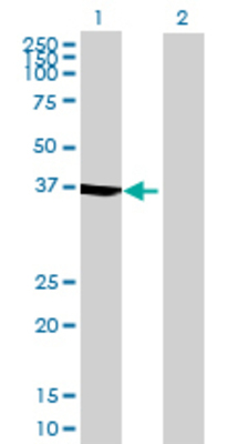 Lane 1: IVD transfected lysate (46.64 KDa) Lane 2: Non-transfected lysate.