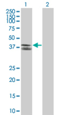 Lane 1: LASS2 transfected lysate (41.91 KDa) Lane 2: Non-transfected lysate.
