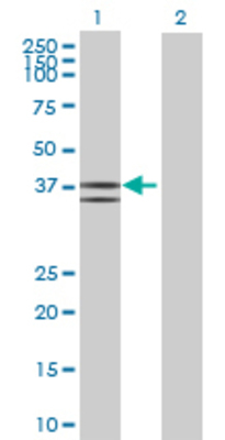 Lane 1: ST3GAL2 transfected lysate (38.61 KDa) Lane 2: Non-transfected lysate.