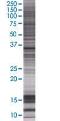 LZTFL1 transfected lysate.