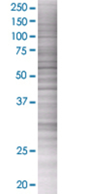 KPNA2 transfected lysate.