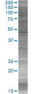 CBX8 transfected lysate.