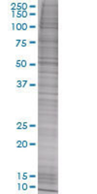 BNIPL transfected lysate