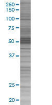 ABLIM1 transfected lysate.