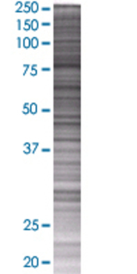 TRPC4AP transfected lysate.
