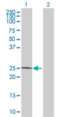 Lane 1: SPA17 transfected lysate (16.72 KDa) Lane 2: Non-transfected lysate.