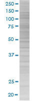 SOD1 transfected lysate.