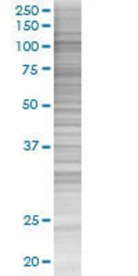 MCM6 transfected lysate.