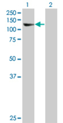Lane 1: MCM6 transfected lysate (90.42 KDa) Lane 2: Non-transfected lysate.