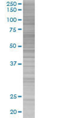 FLJ20516 transfected lysate.