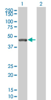 Lane 1: SAV1 transfected lysate (44.6 KDa) Lane 2: Non-transfected lysate.
