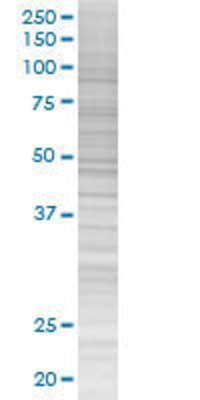 MDS028 transfected lysate.