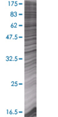 GALM transfected lysate.