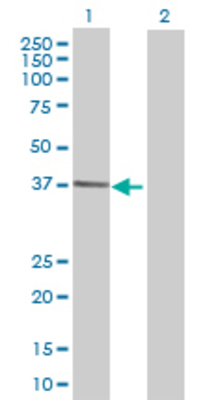 Lane 1: GALM transfected lysate (37.73 KDa) Lane 2: Non-transfected lysate.