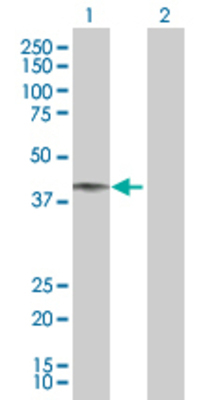 Lane 1: HFE transfected lysate (40.1 KDa) Lane 2: Non-transfected lysate.