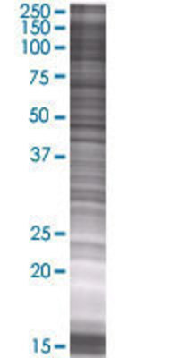 THBS1 transfected lysate.
