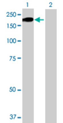 Lane 1: THBS1 transfected lysate (128.81 KDa) Lane 2: Non-transfected lysate.