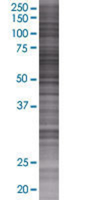 SGSH transfected lysate.