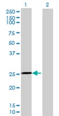 Lane 1: C1QTNF5 transfected lysate (26.84 KDa) Lane 2: Non-transfected lysate.