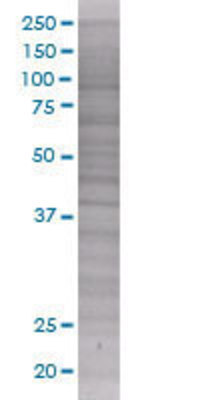 SUV39H2 transfected lysate.