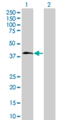 Lane 1: SUV39H2 transfected lysate (39.9 KDa) Lane 2: Non-transfected lysate.