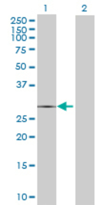 Lane 1: CTSG transfected lysate (28.16 KDa) Lane 2: Non-transfected lysate.