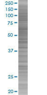TH1L transfected lysate.