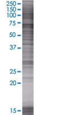 GFPT2 transfected lysate.