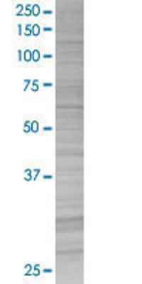 LGALS3 transfected lysate.