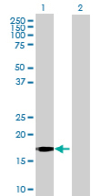 Lane 1: IFNA5 transfected lysate (20.9 KDa) Lane 2: Non-transfected lysate.