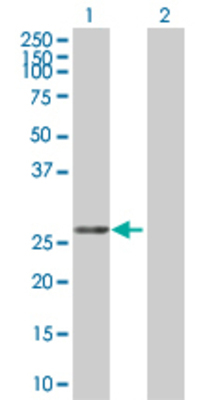 Lane 1: COASY transfected lysate (29.7 KDa) Lane 2: Non-transfected lysate.