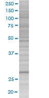 COASY transfected lysate.