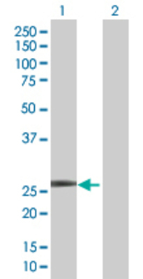 Lane 1: IFIH1 transfected lysate (25.1 KDa) Lane 2: Non-transfected lysate.