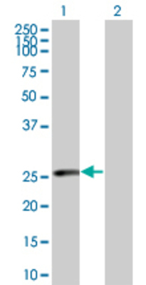 Lane 1: RAD51L3 transfected lysate (23.3 KDa) Lane 2: Non-transfected lysate.