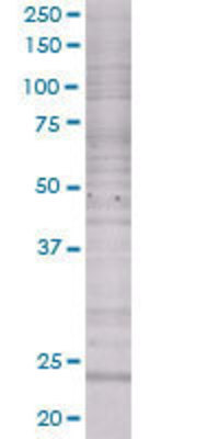 RAD51L3 transfected lysate.