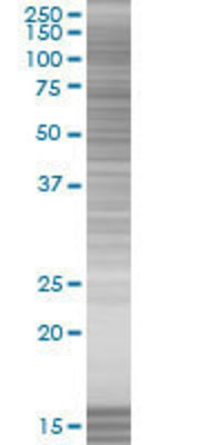 CD84 transfected lysate.