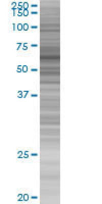 CEP57 transfected lysate.