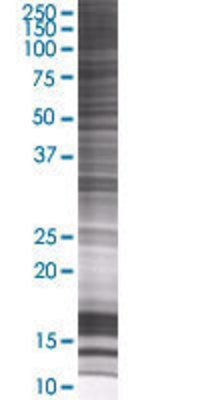 KIAA0323 transfected lysate.