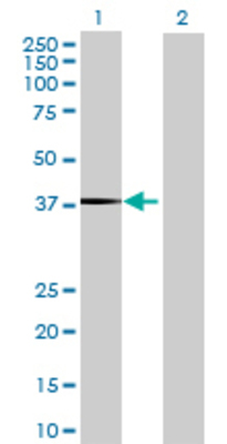 Lane 1: ST6GALNAC2 transfected lysate (41.25 KDa) Lane 2: Non-transfected lysate.