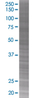 SNX1 transfected lysate