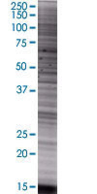 ST6GALNAC1 transfected lysate.