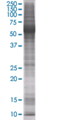 ARHGDIA transfected lysate