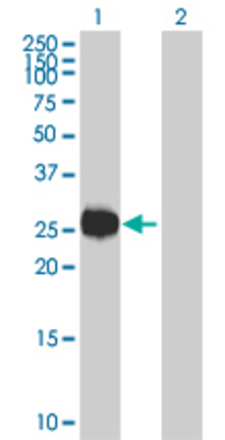 Lane 1: ARHGDIA transfected lysate (22.55 KDa). Lane 2: Non-transfected lysate.