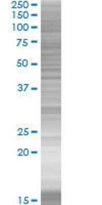 TGIF2 transfected lysate.