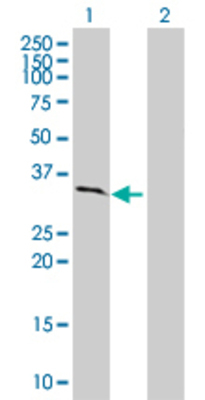 Lane 1: THY1 transfected lysate (15.62 KDa). Lane 2: Non-transfected lysate.